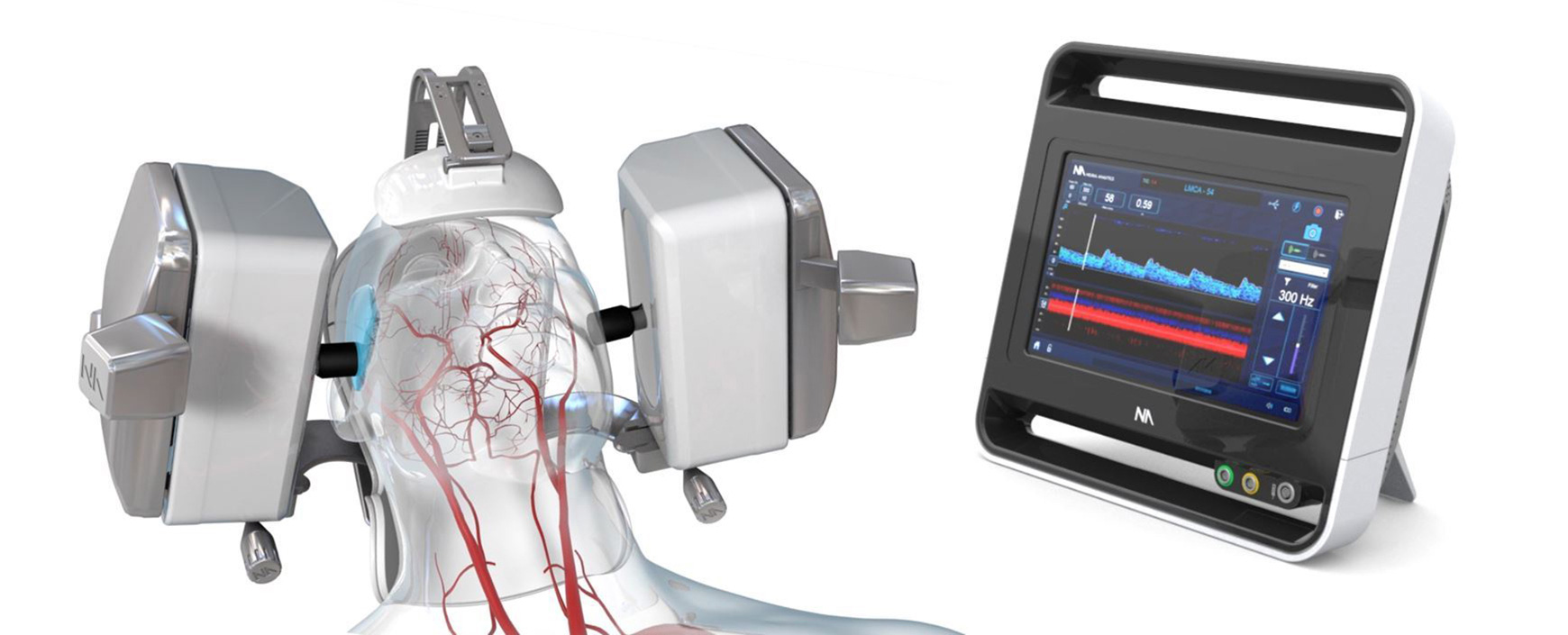 Robotic ultrasound for stroke