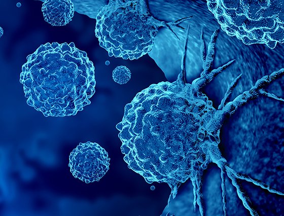 Cancer_Center_thumb_600x456.jpg